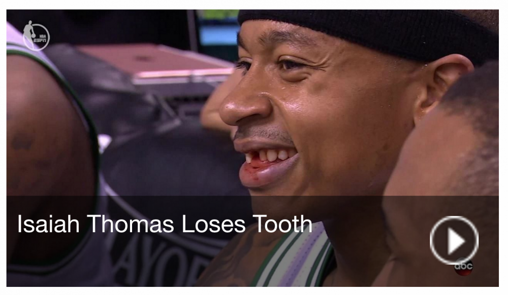 Screenshot 2017-04-30 10.58.13.png